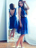 Black Homecoming Dresses,Lace Homecoming Dress,Backless Homecoming Dress,HC00022